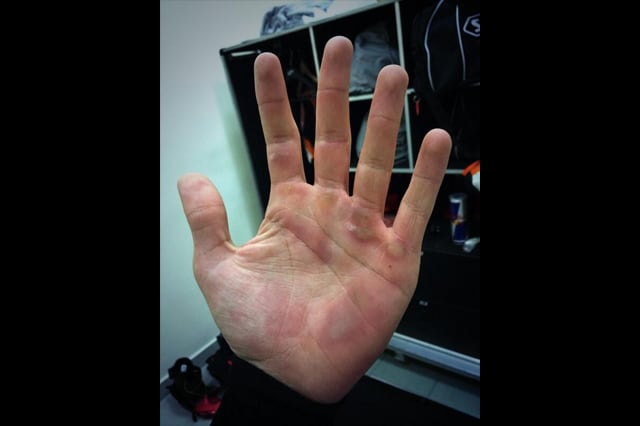 Marquez: mani da lavoratore!