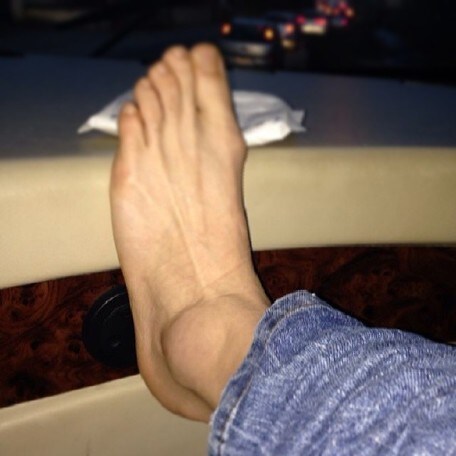 Cairoli, che botta alla caviglia!