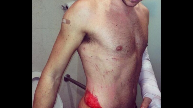 Searle: consulto dallo specialista inglese