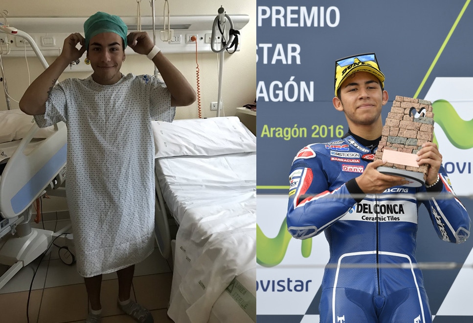 Bastianini operazione ok, tolta la placca dal polso destro