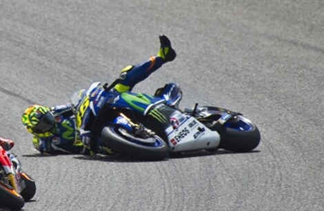 Valentino Rossi: “rubata” dall'ospedale la lastra della gamba
