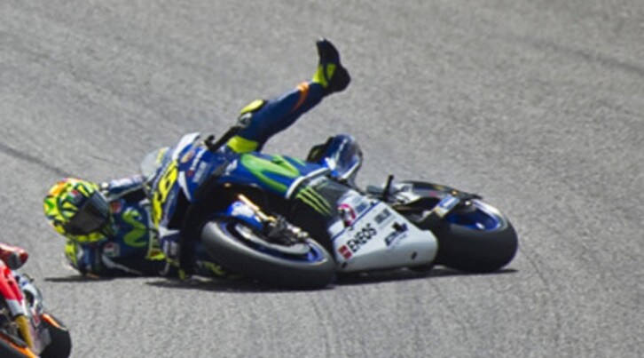 Valentino Rossi: “rubata” dall'ospedale la lastra della gamba