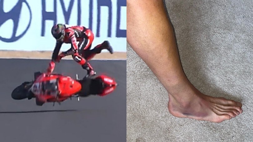 SBK: il guerriero Scott Redding - FOTO