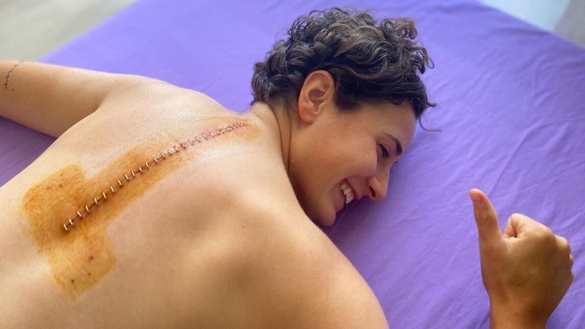 Ana Carrasco: le radiografie dell'intervento - FOTO