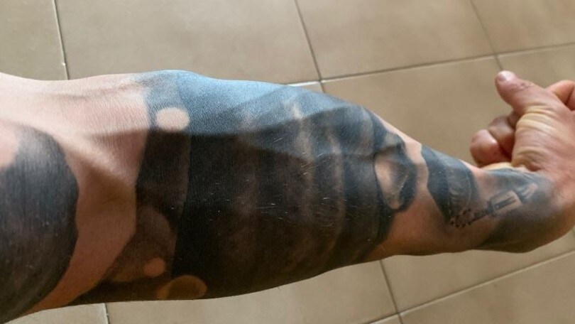 CIV, braccio destro ko: Delbianco presto sotto i ferri