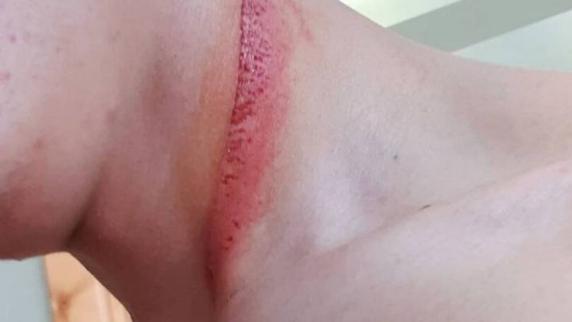 Moto3 GP Spain, scare for Oncu: “It’s a miracle I’m alive”