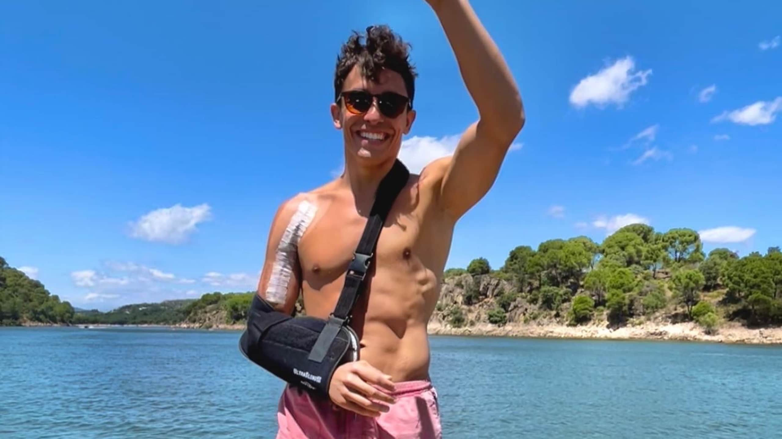 MotoGP, le immagini shock della cicatrice di Marc Marquez