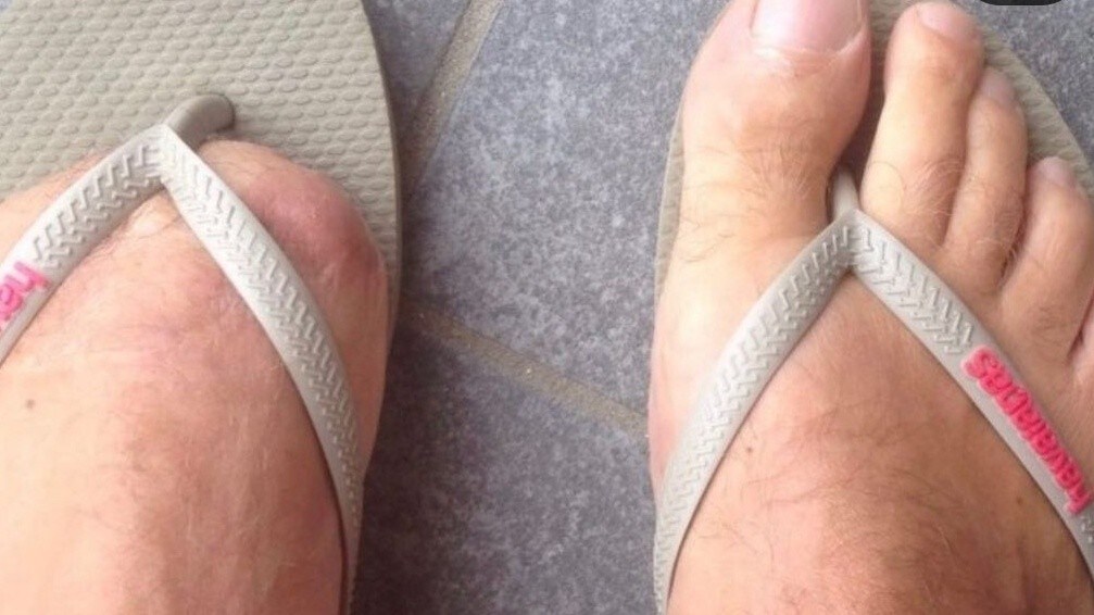 Batteva Doohan con un piede e mezzo: Beattie, vice iridato 500