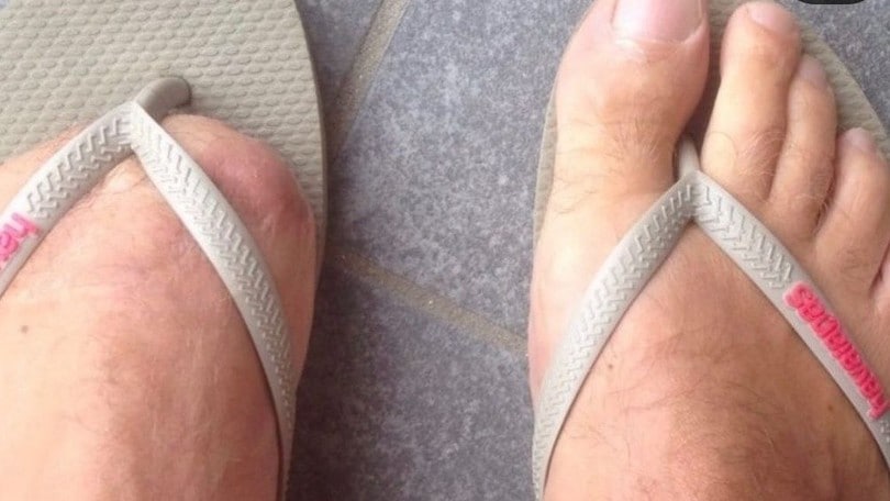 Batteva Doohan con un piede e mezzo: Beattie, vice iridato 500