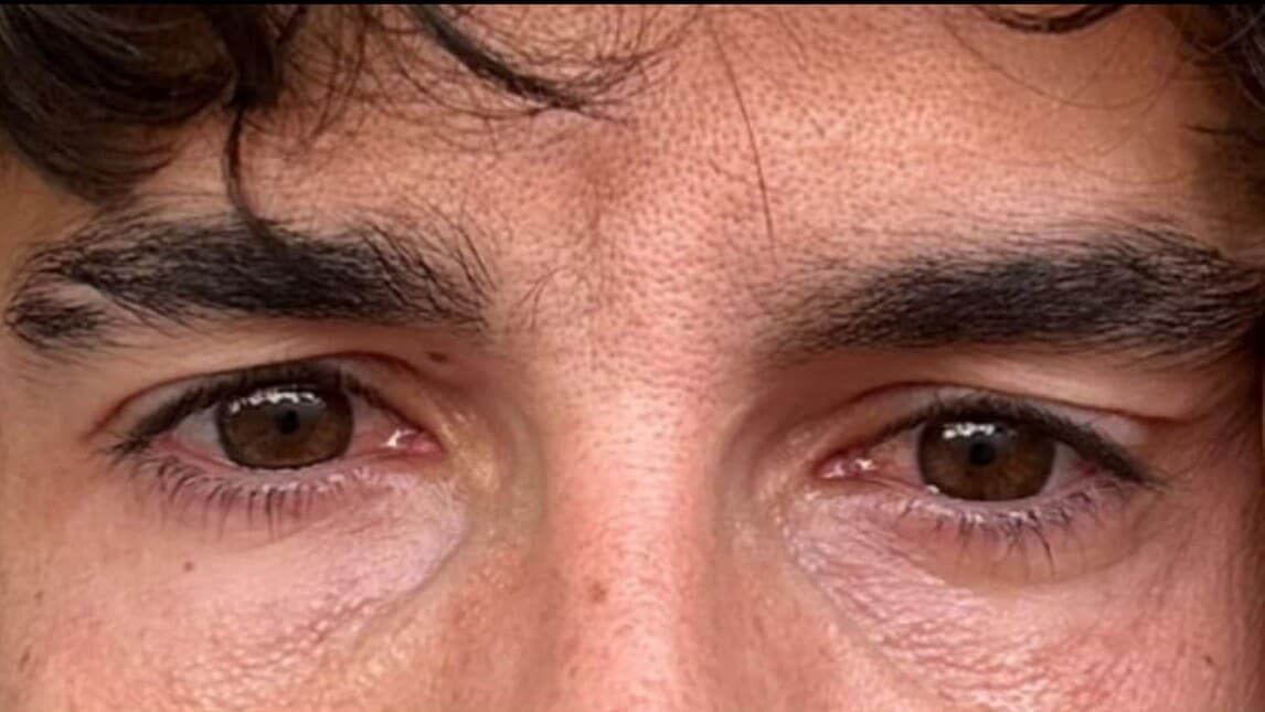 Marquez breaks the silence: “You will always be the team in my heart”