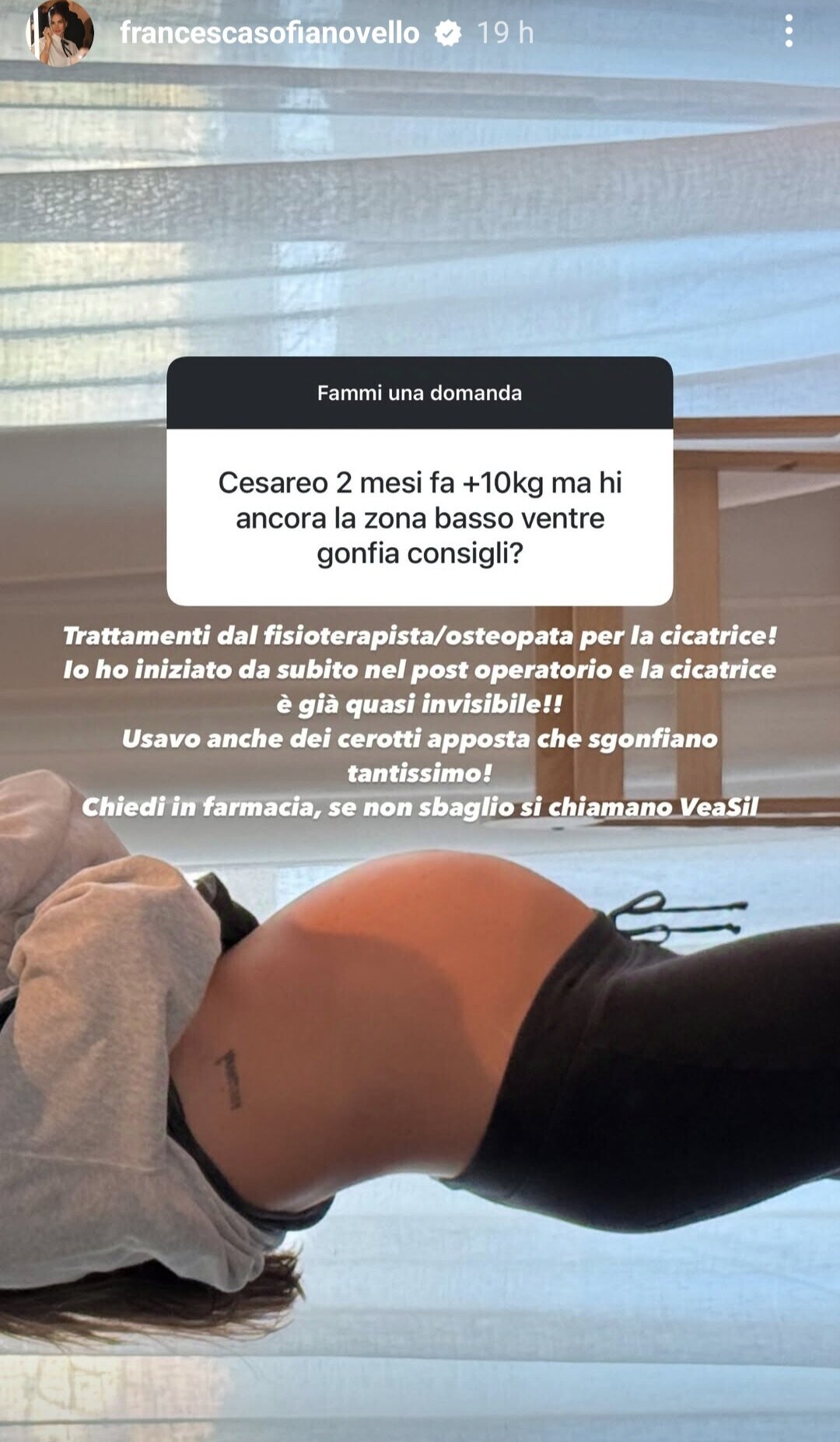 Francesca Sofia Novello svela: "Il parto è vicino, sarà un cesareo"