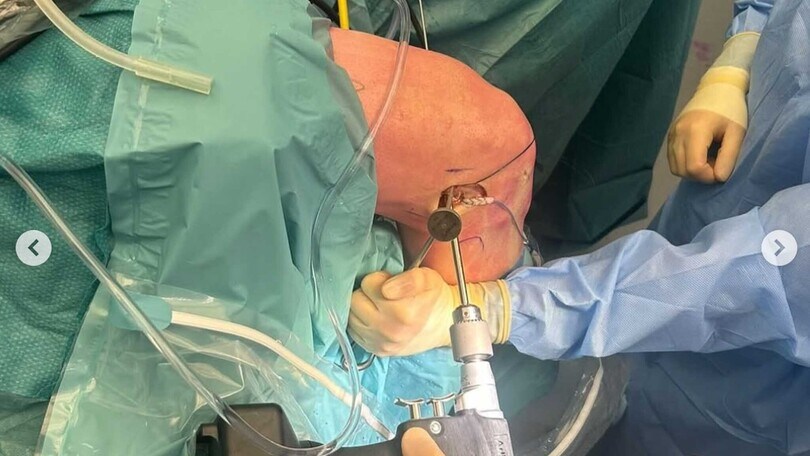 MXGP: Herlings conferma le voci sull’infortunio