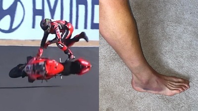 SBK: il guerriero Scott Redding - FOTO