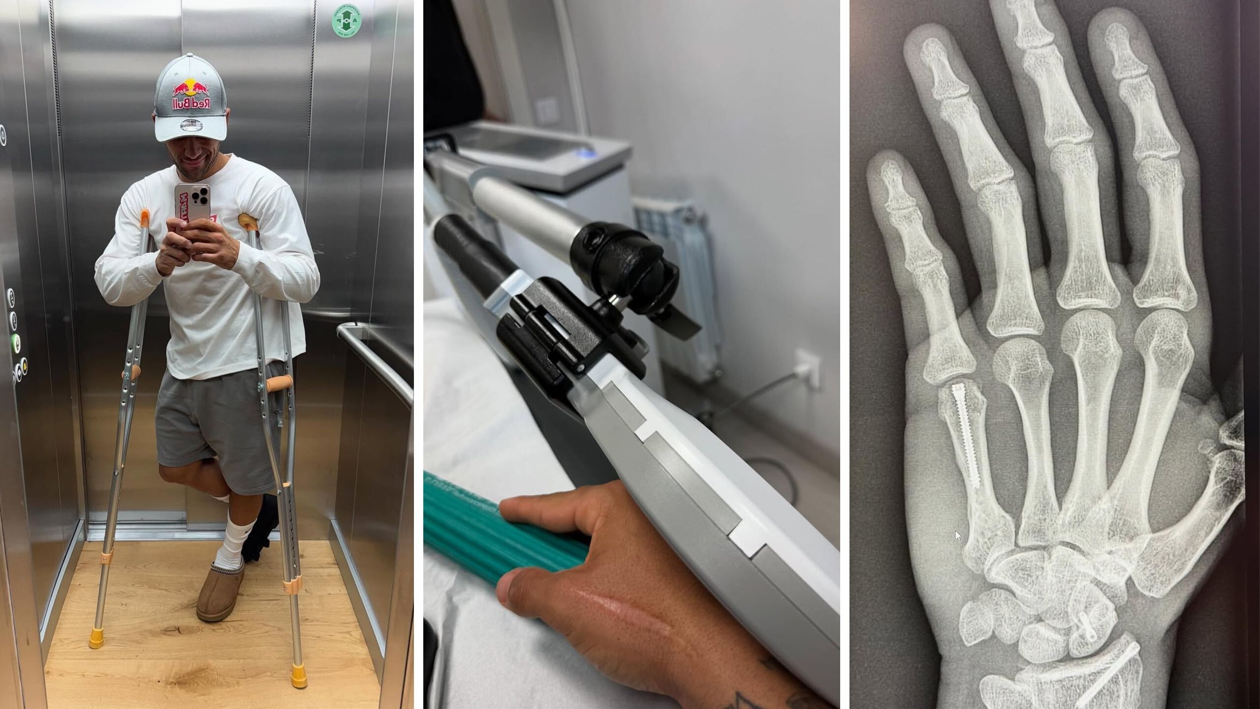 MotoGP, aggiornamento sulle condizioni di Jorge Martin dopo il disastroso incidente