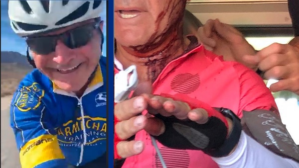 Miguel Duhamel ferito alla testa da una pistola BB