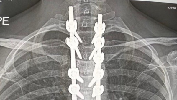 Ana Carrasco: “Ecco com’è la mia schiena. Presto vi svelo il mio futuro”