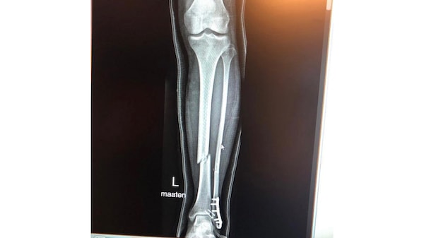 MotoGP: infortunio alla tibia per Mika Kallio