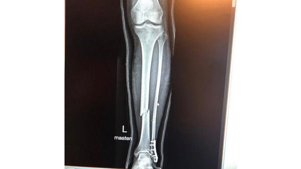 MotoGP: infortunio alla tibia per Mika Kallio