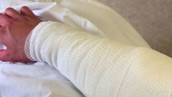 CIV Superbike: Delbianco, operazione riuscita e... 30 punti in più