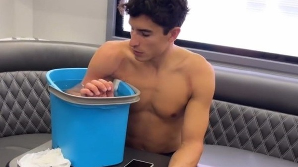 MotoGP, Marquez "rinfresca" il braccio: Marc tornerà come prima?