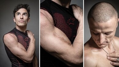 Cicatrici e ferite: come le cadute segnano i corpi dei piloti MotoGP