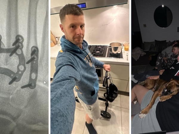 SBK, aggiornamento sulle condizioni di Jonathan Rea