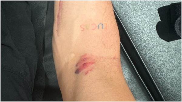 MotoGP: Alex Rins colpito da un sasso: “Volevo quasi rientrare ai box e ritirarmi”