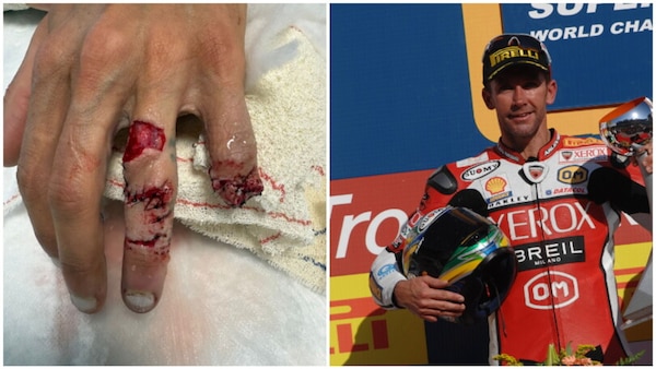 EWC, Saltarelli come Bayliss nel 2007: falange amputata per tornare a correre