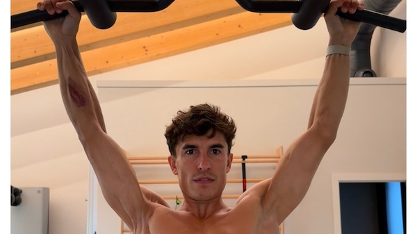 Marquez pubblica una foto del suo braccio
